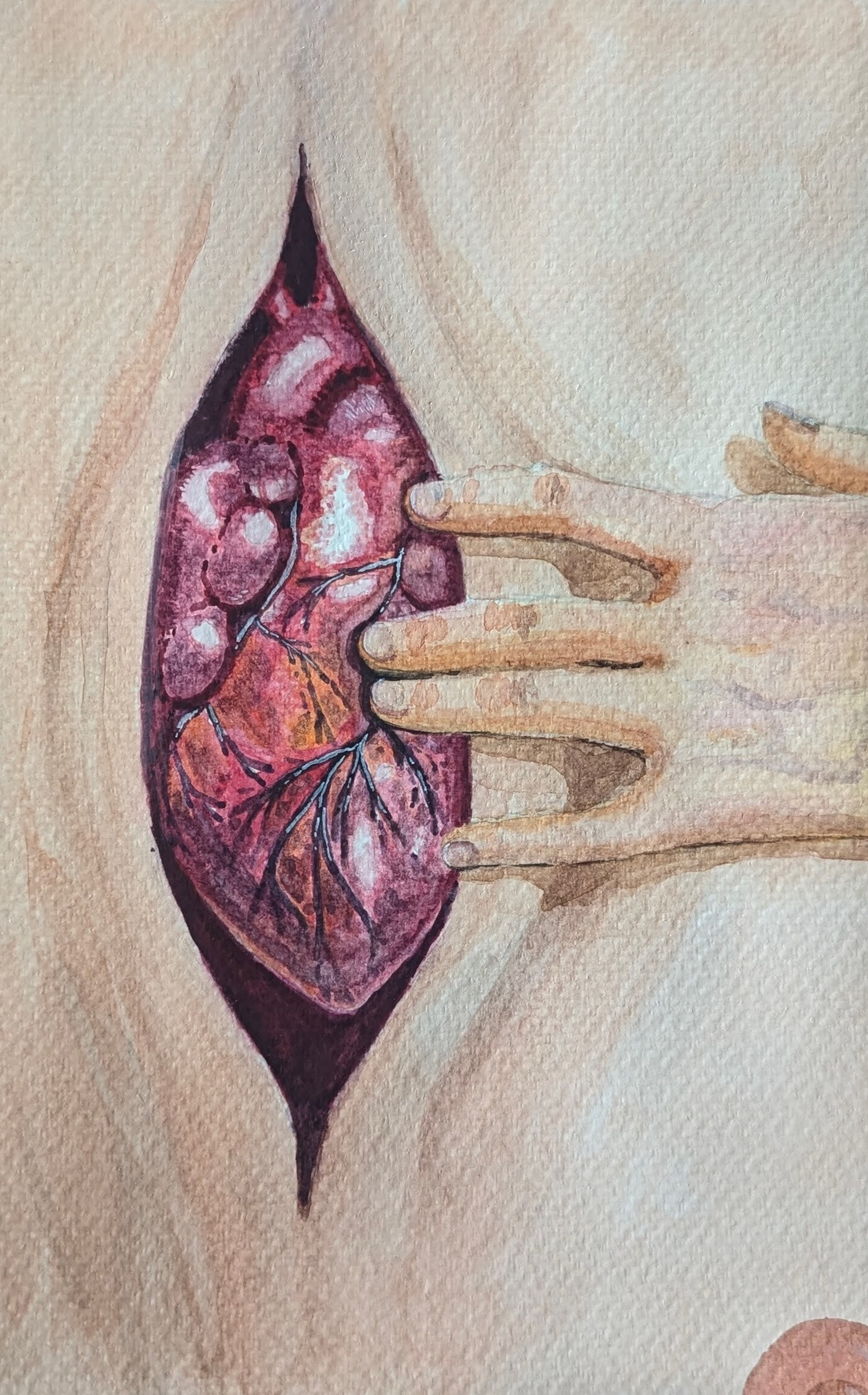 heart surgery